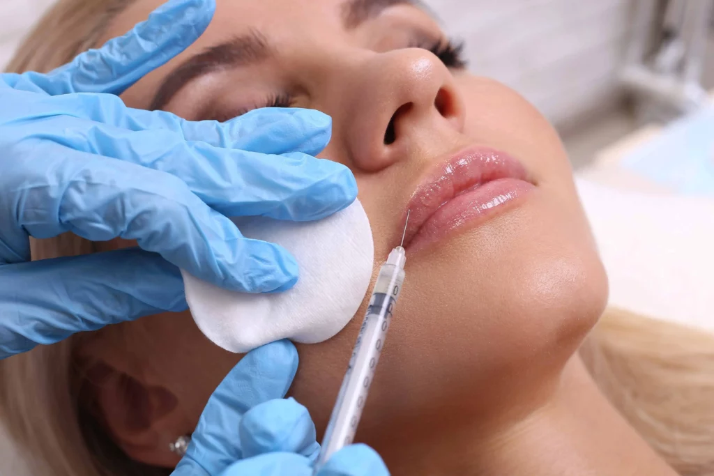 Fillers Treatment by Bellus Medical Aesthetics in Minot, ND