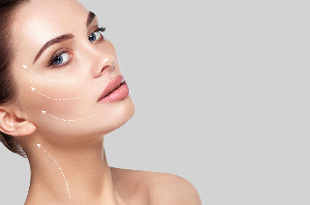Endolift Facelift by Bellus Medical Aesthetics in Minot, ND