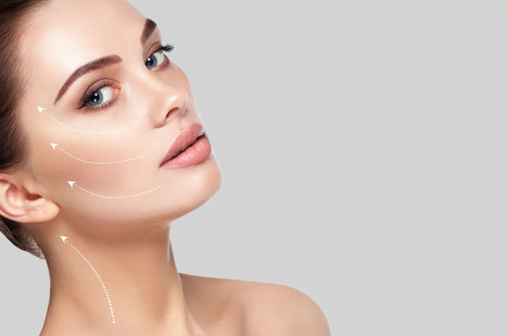 Endolift Facelift by Bellus Medical Aesthetics in Minot, ND