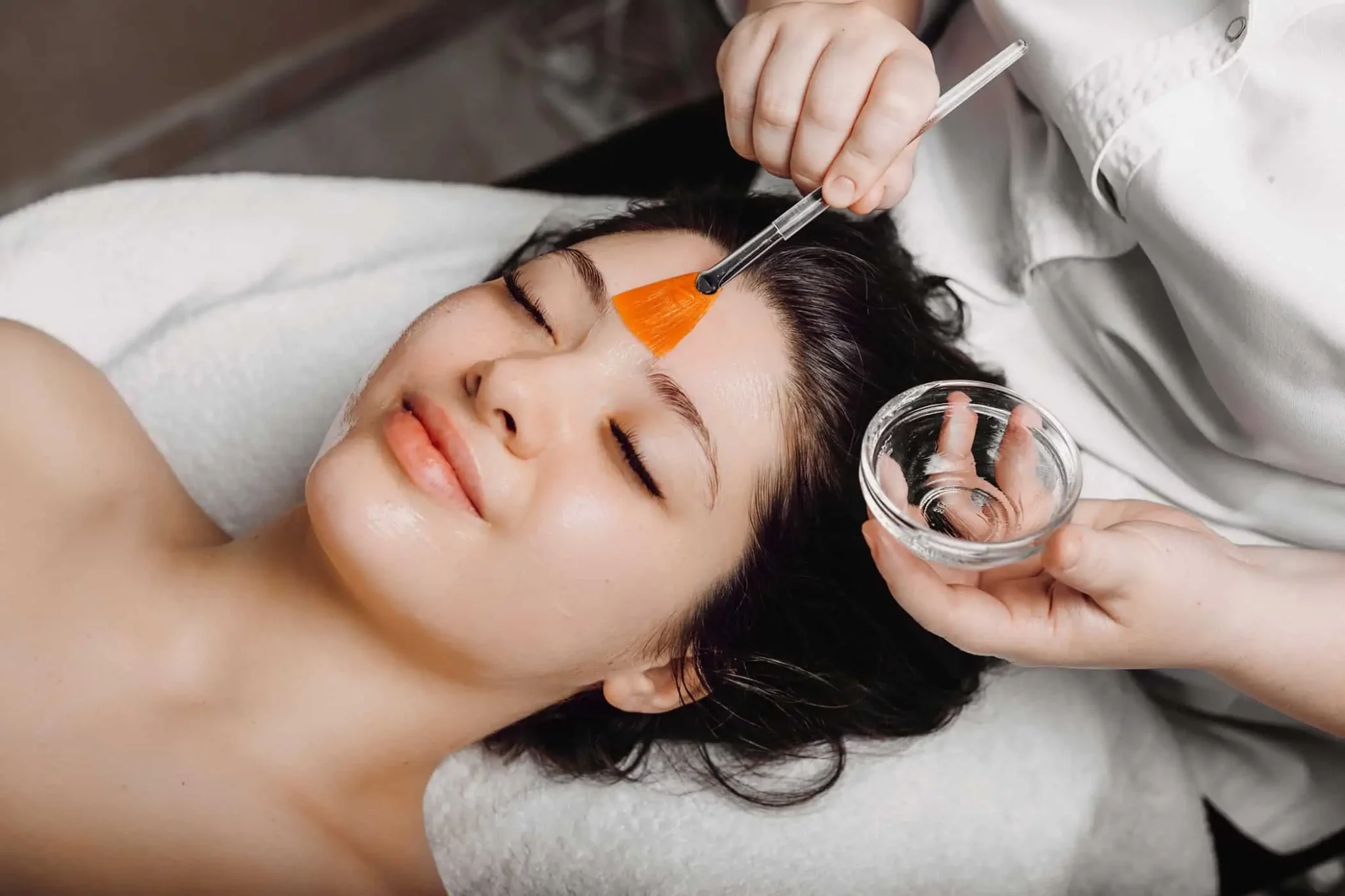 Chemical Peels Services by Bellus Medical Aesthetics in Minot, ND