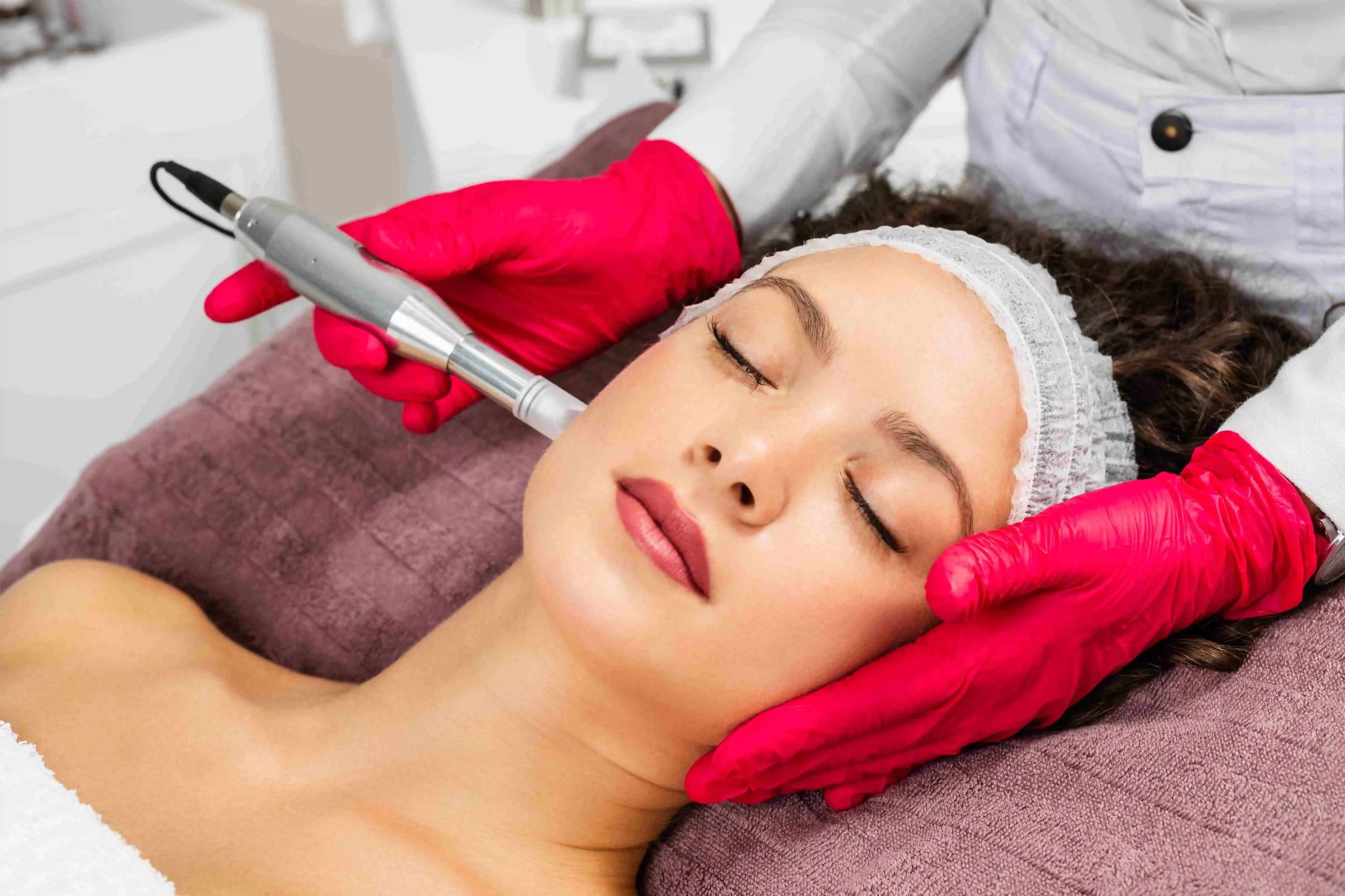 Microneedling with PRF Treatment by Bellus Medical Aesthetics in Minot, ND